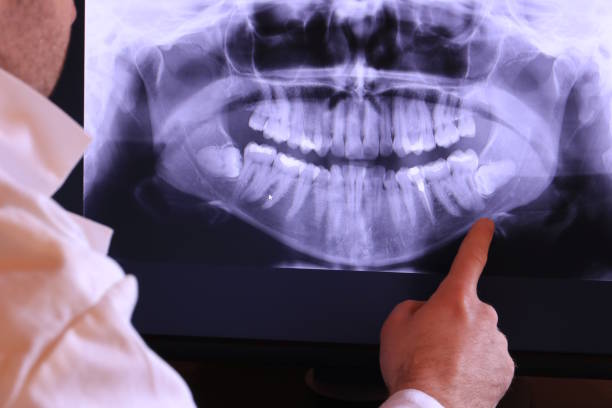 Best Emergency Treatment for Toothache in Ashburn, VA