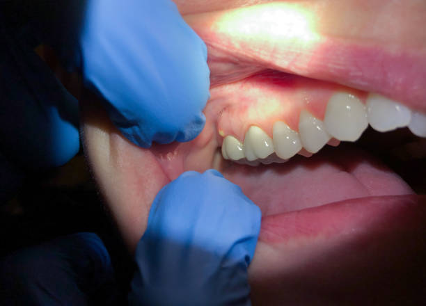 Best After-Hours Emergency Dentist in Ashburn, VA